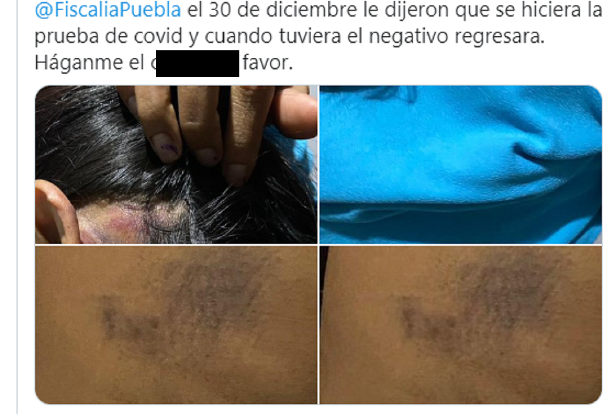 LAMENTABLE Fiscalía de #Puebla pide a poblana golpeada prueba negativa de #Covid19 antes de recibir su denuncia