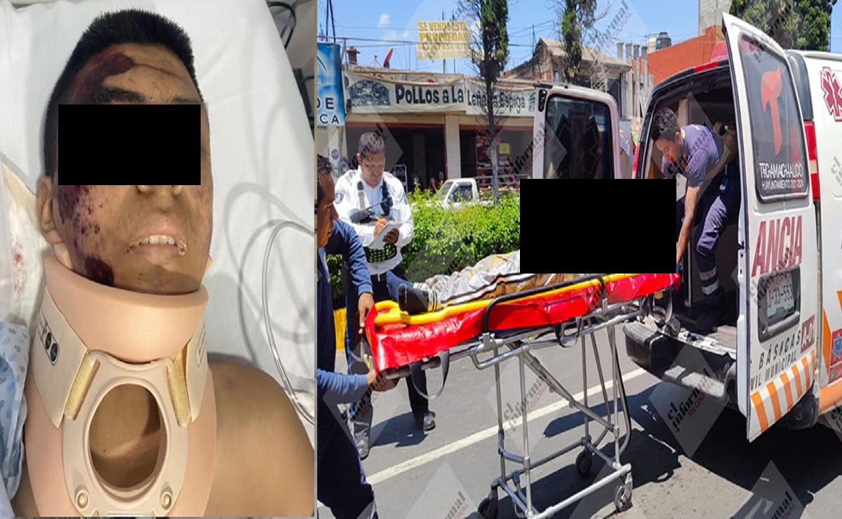 Atropellan y matan a Chuchín; jovencito de 16 años que intentaba cruzar la calle