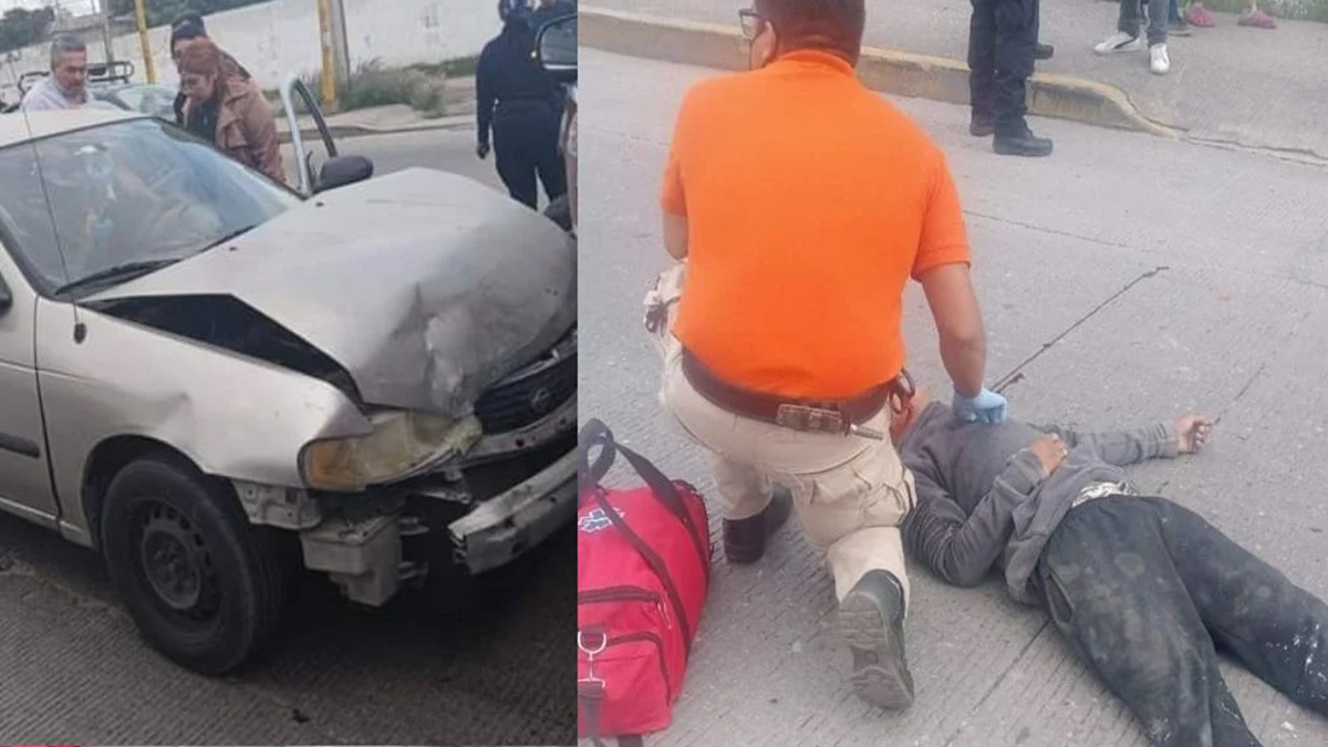 Joven Ladrón Atropellado Durante Persecución Policial en Amozoc