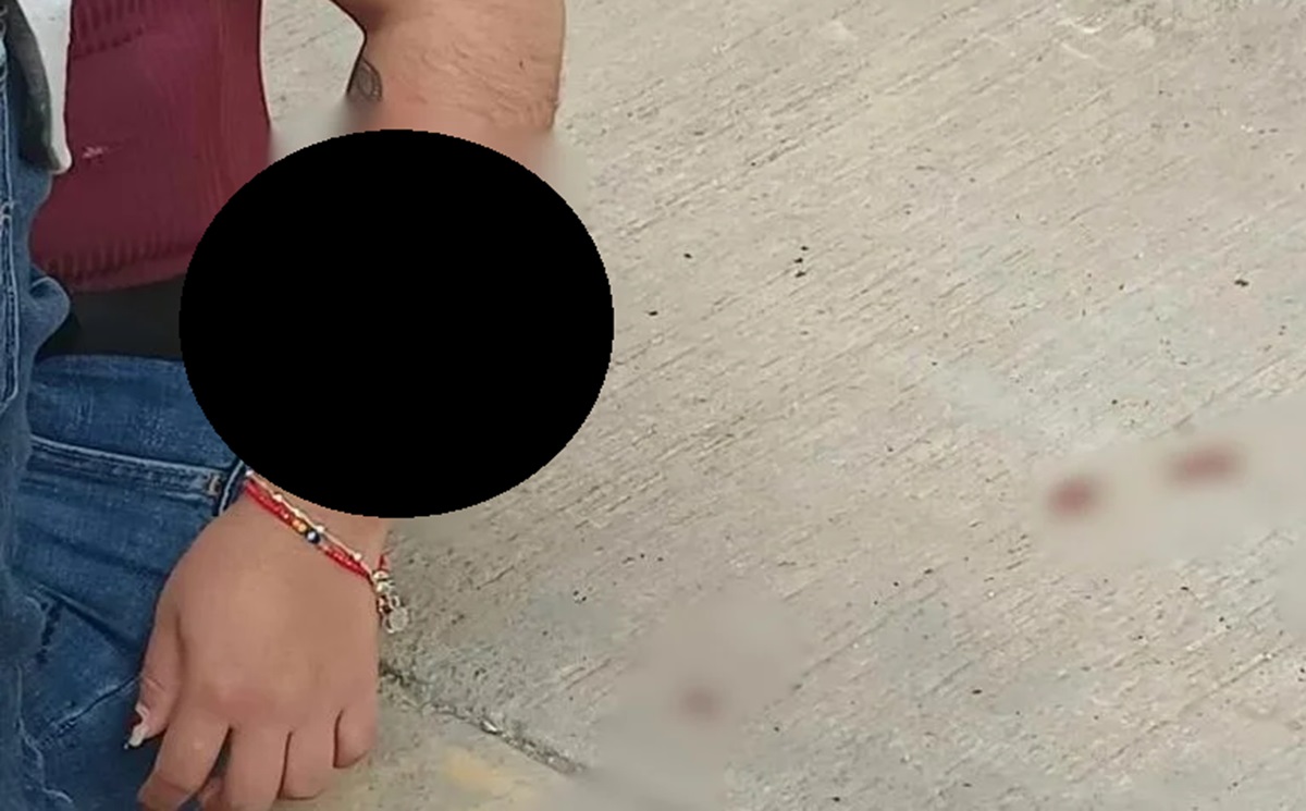 Perro callejero ataca brutalmente a poblana y le destroza un brazo en Cuautlancingo; vecinos exigen acciones