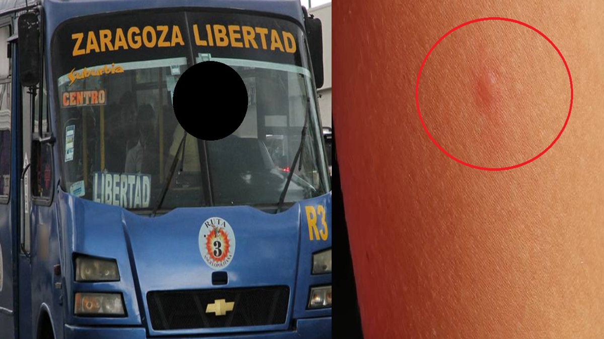 Una joven de Puebla denunció que un desconocido le inyectó una sustancia mientras viajaba en la Ruta 3