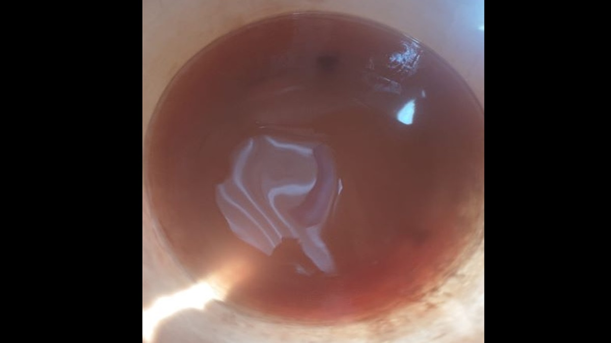 Crisis en Puebla: Agua contaminada provoca vómitos y enfermedades; vecinos amenazan con bloqueos