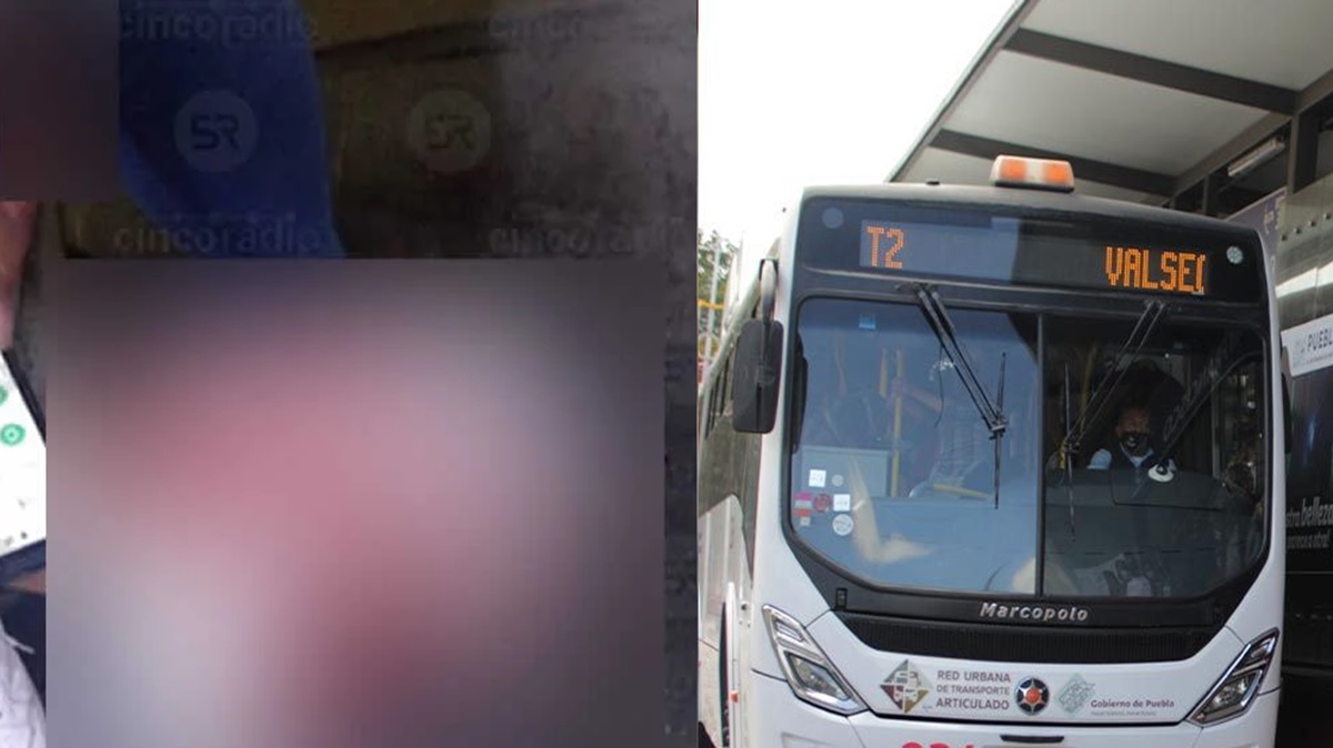 ¡Impactante FOTO! Una mujer casi pierde un dedo tras un accidente en la Línea 2 de RUTA.