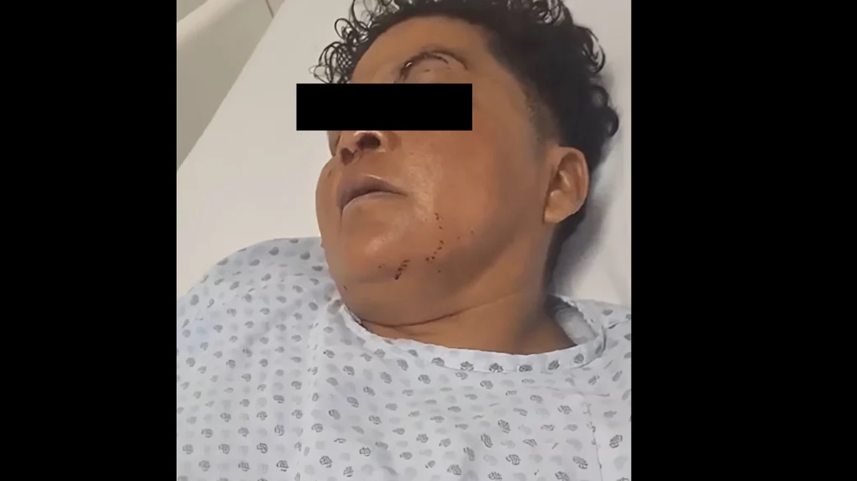 Brutal ataque a “La China” en Izúcar: activista y vendedora de elotes lucha por su vida