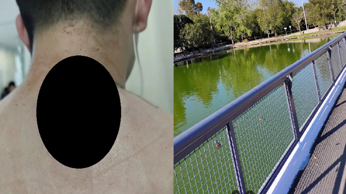 ¡Terror en el Parque Ecológico! Atacan a pareja a cuchilladas para asaltarlos en Puebla