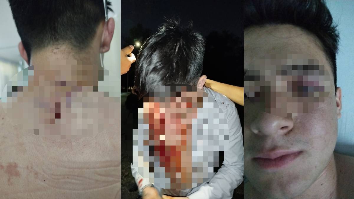Asaltante del Parque Ecológico de Puebla identificado desde hace 2 años sigue libre: estudiante apuñalado exige justicia