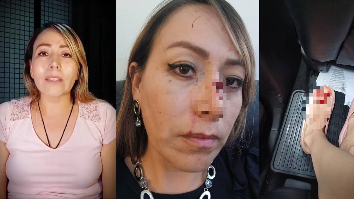 Terror en Tehuacán: Mujer Sobrevive a Brutal Agresión y Denuncia Amenazas de Muerte Contra Ella y su Familia