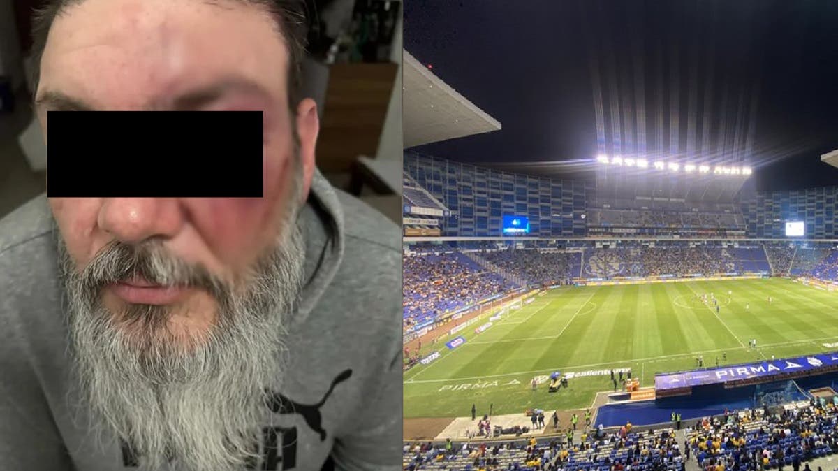 Fer Jara, conductor de SICOM, recibe brutal golpiza por llevar gorra de Pumas tras partido en el Cuauhtémoc