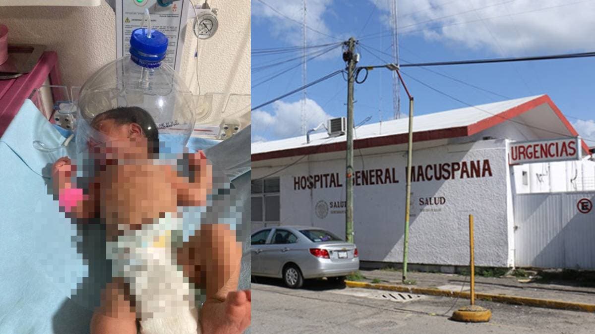 “Casco de plástico para un recién nacido”: improvisación médica en Tabasco destapa crisis hospitalaria