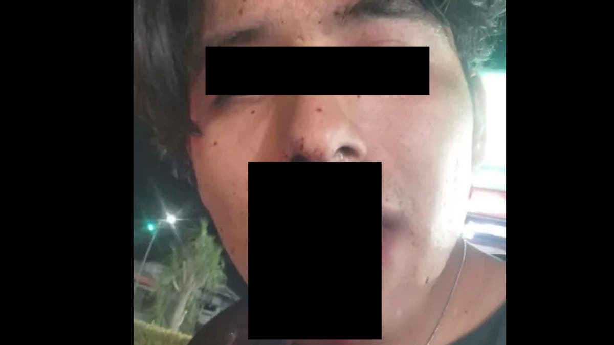 Brutal ataque en Bugambilias: joven pierde dientes tras ser golpeado con piedra