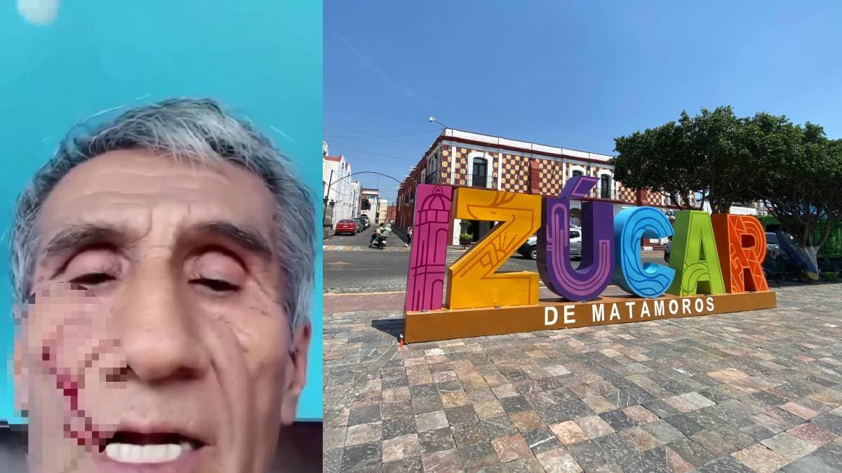 Un hombre de 69 años denuncia una agresión física por parte de sus hijas, funcionarias públicas en Puebla