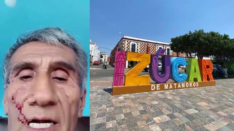 Un hombre de 69 años denuncia una agresión física por parte de sus hijas, funcionarias públicas en Puebla