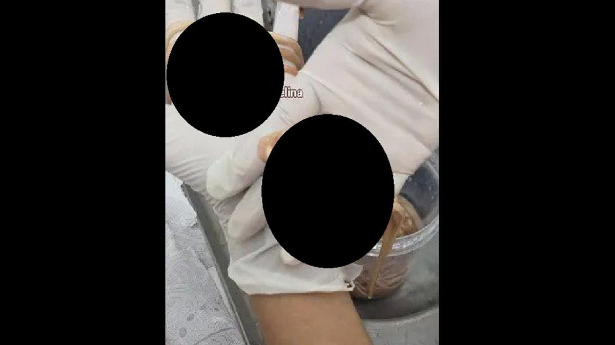 Alerta: Extraen 142 lombrices del cuerpo de un niño de 7 años