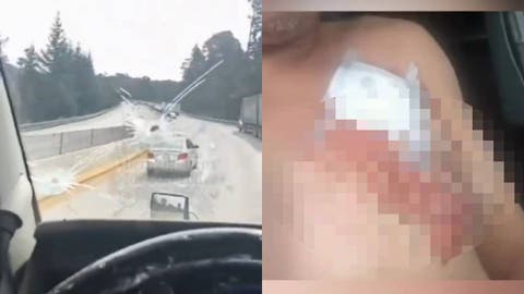 Terror en la Ruta: Atacan a Operador de Tráiler en la México-Puebla y Lo Dejan Malherido