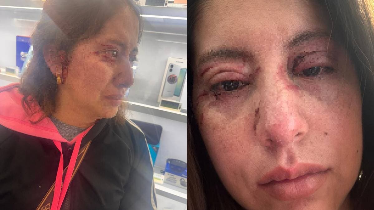 Madre denuncia brutal agresión en el mercado de Atlixco frente a su hijo autista: exige justicia y protección