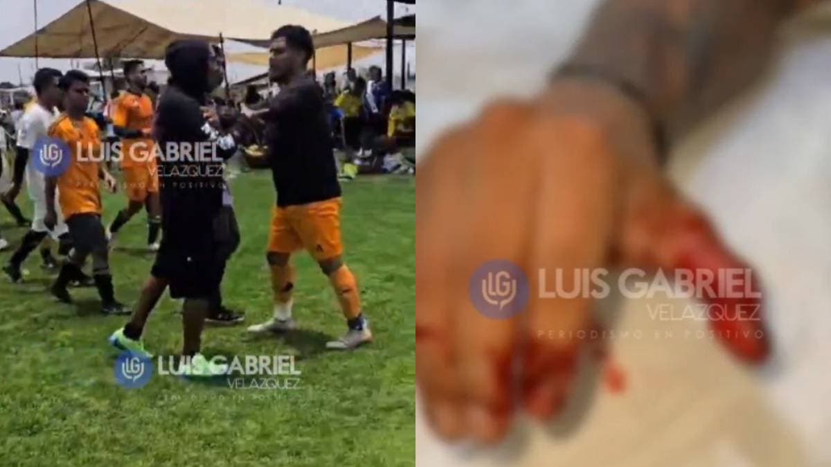 Cancha de violencia: jugadores apuñalados y golpeados en partido de liga amateur en Puebla; acusan encubrimiento