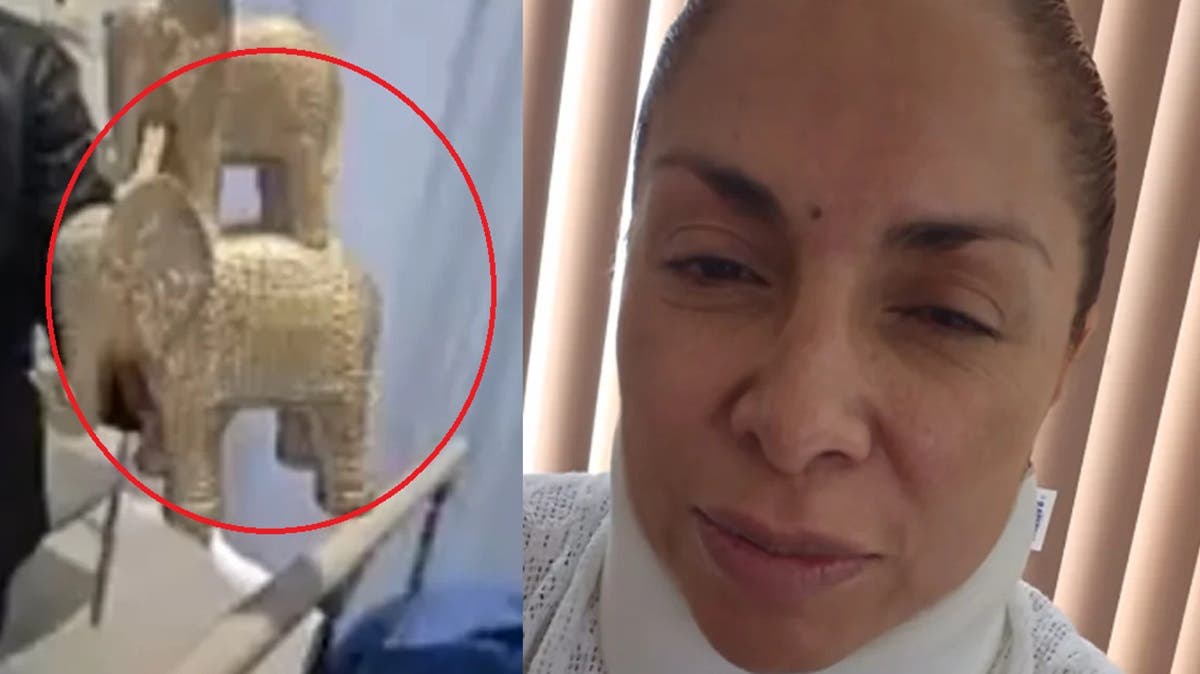 “Pronto darán con #LadySears”: víctima del ataque en Sears Angelópolis sale del hospital y pide justicia