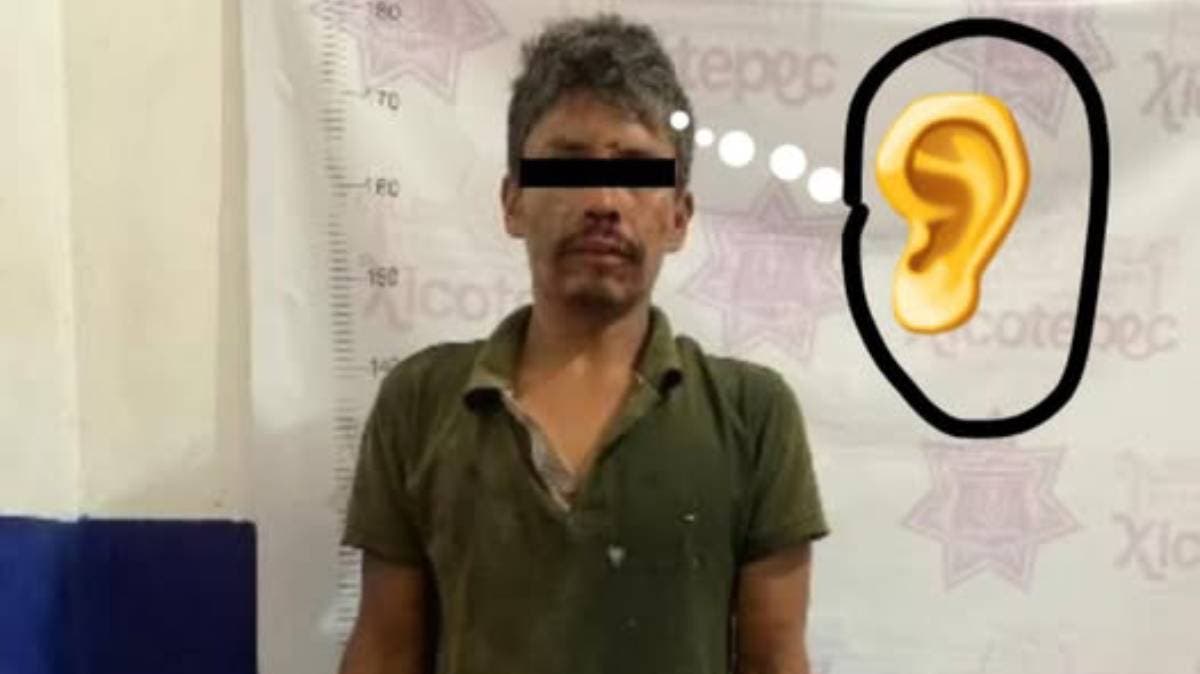 ¡Riña brutal en Xicotepec! Hombre arranca oreja a su rival en plena calle