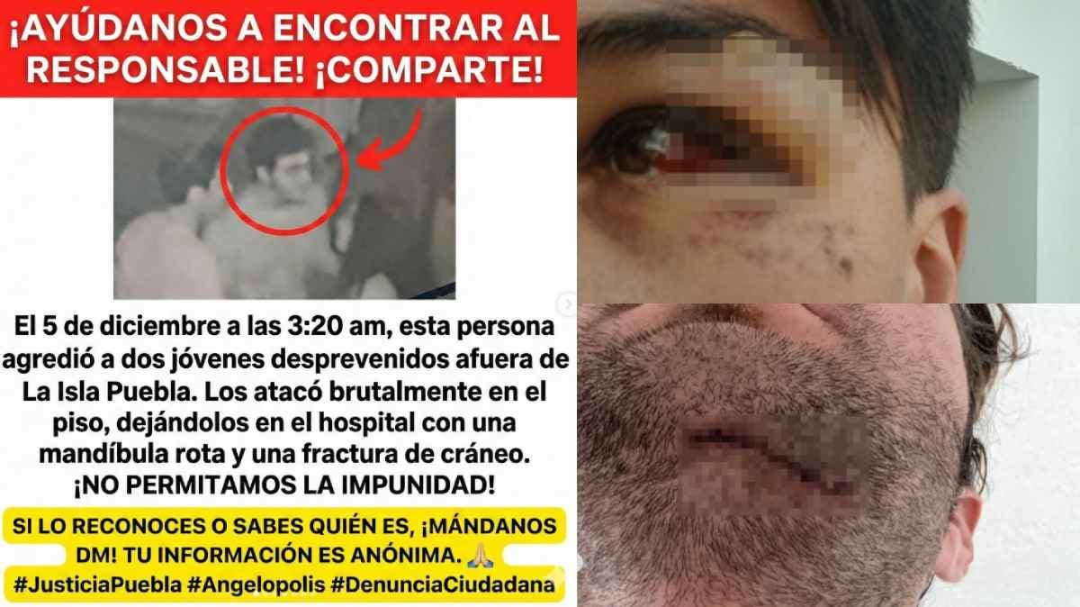 Joven denuncia agresión violenta afuera de La Isla Angelópolis; pide apoyo para identificar al responsable