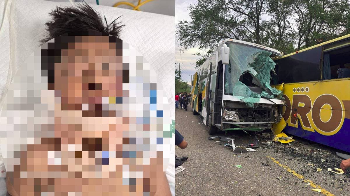 Menor de Izúcar herido en choque de autobuses Oro y Sur en Guerrero