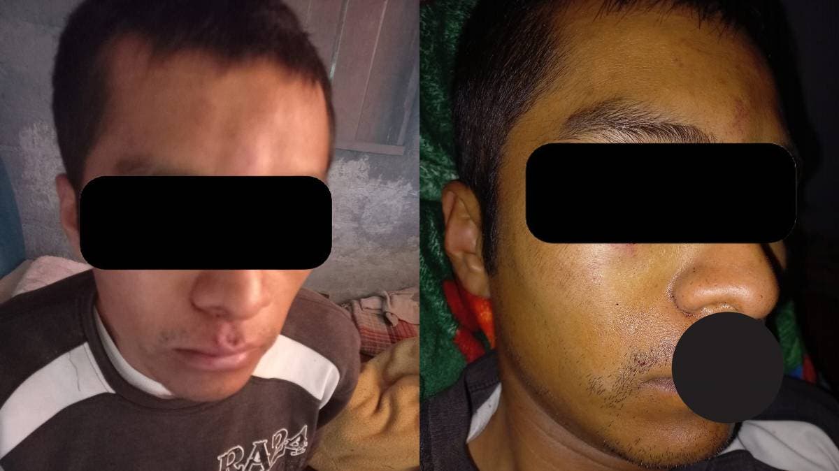 Tehuacán: acusan a “viene viene” de robo y lo golpean brutalmente