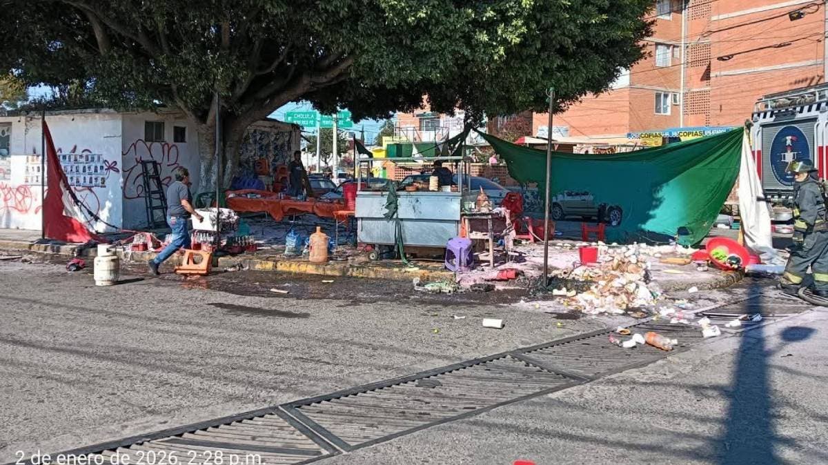 Quemados y olvidados: víctimas de explosión en Agua Santa enfrentan abandono y gastos médicos