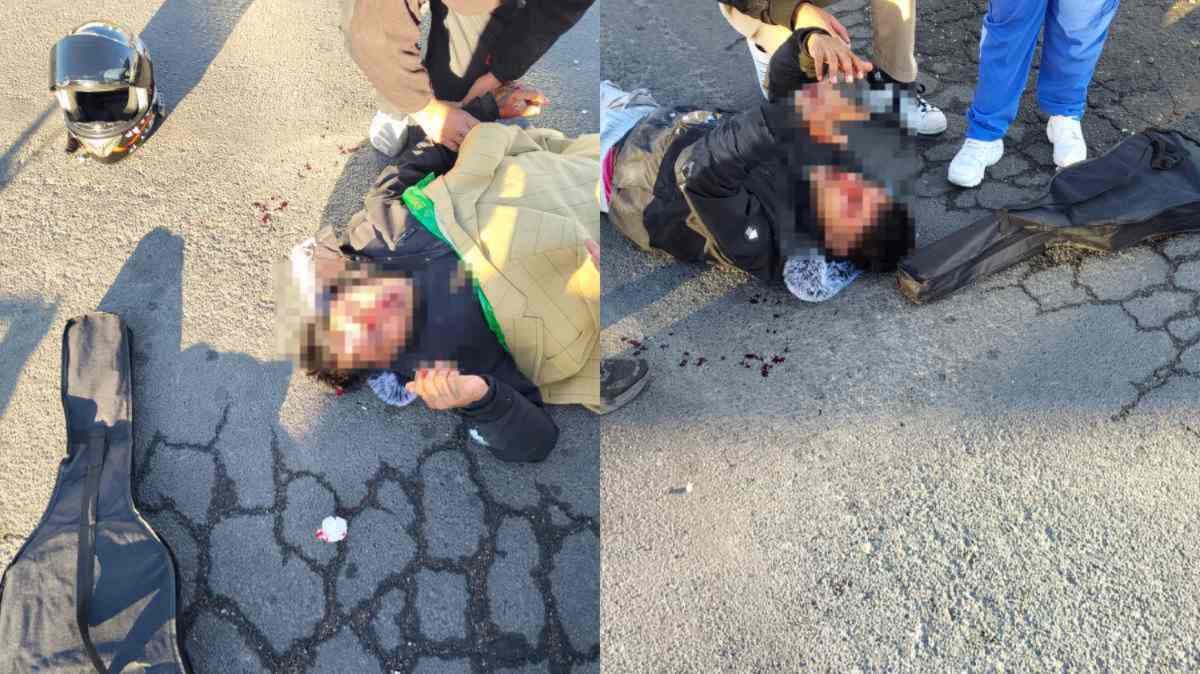 Jóvenes resultan gravemente heridos tras accidente en la carretera San Rafael por presencia de perros en vía pública