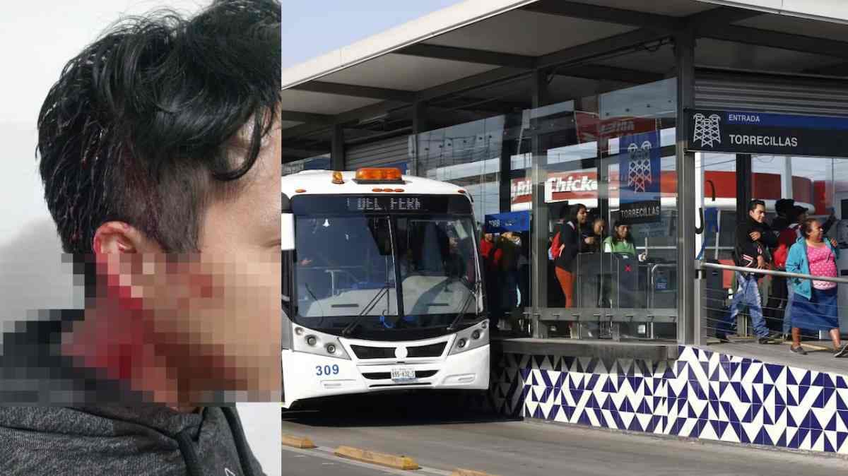 Asalto violento en estación Torrecillas deja a hombre herido y genera alarma entre usuarios
