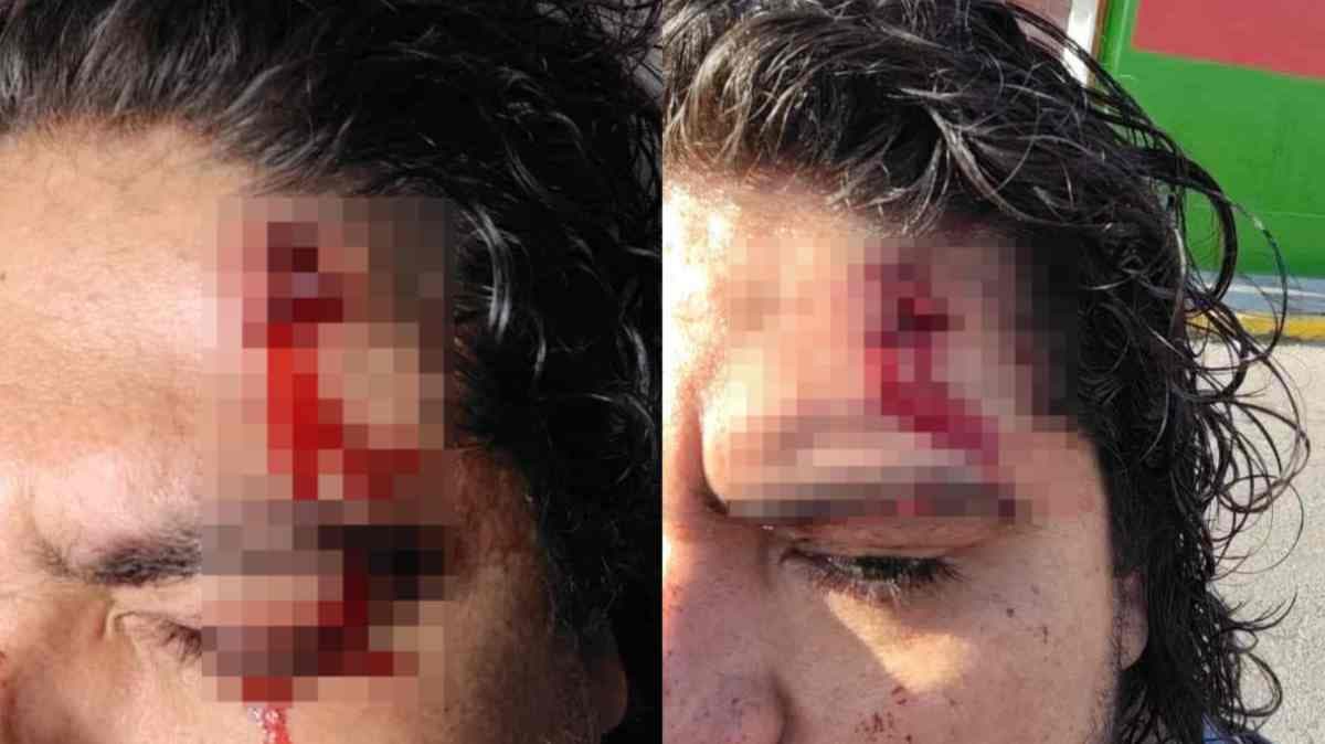 Violencia en la Ruta 17: editor de e-consulta agredido y robado por cinco delincuentes en Puebla