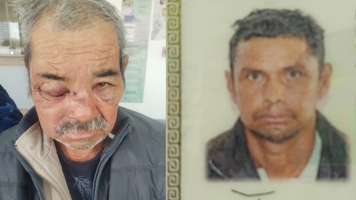 Violencia familiar en Puebla: adulto mayor pierde un ojo tras brutal agresión de su propio hijo