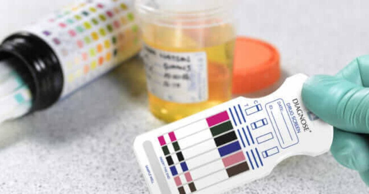 Diputada del PRI exige antidoping obligatorio para candidatos en elecciones de Puebla