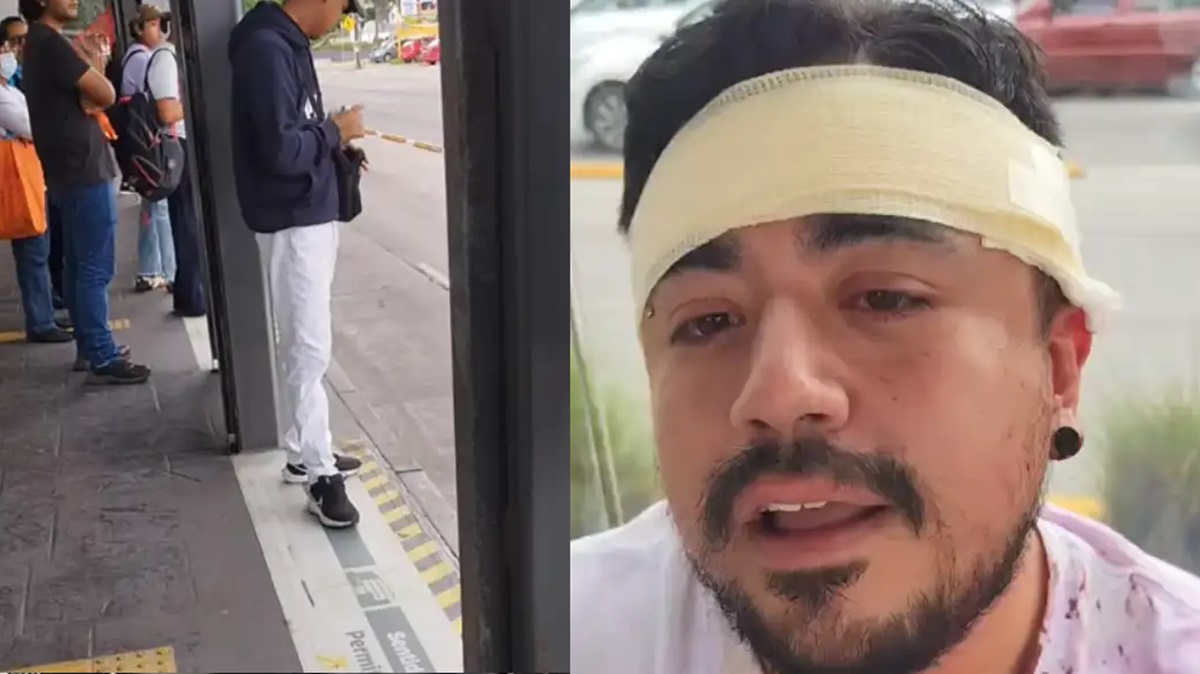 Violenta agresión en paradero del RUTA: carteristas abren la cabeza a golpes a pasajero