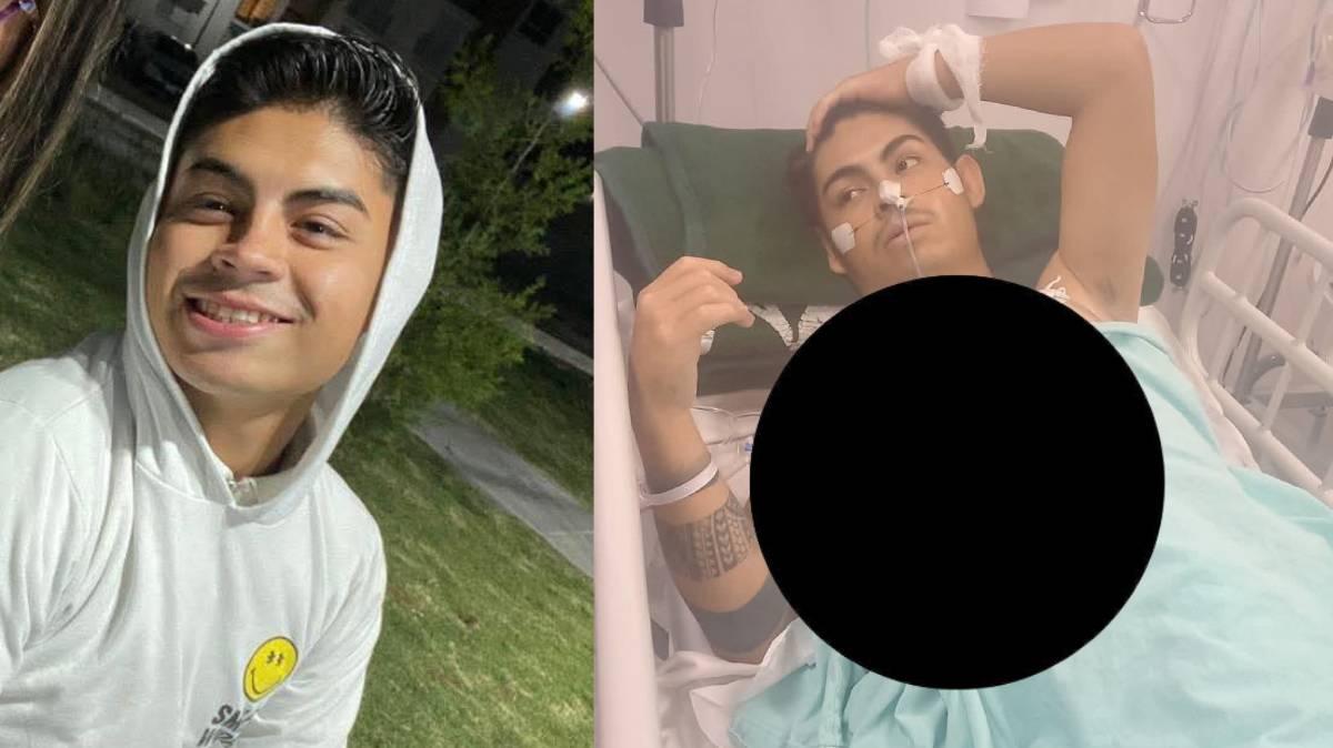 Joven de 21 años permanece grave tras complicaciones médicas en IMSS Cuautlancingo; familia exige revisión del caso