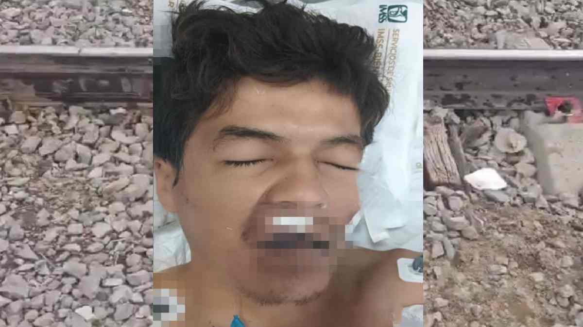 Buscan identificar a joven arrollado por tren en Santa Margarita; sobrevivió pero está grave