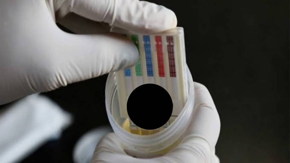 Diputado panista propone antidoping para funcionarios en Puebla: “no solo quienes buscan una boleta”
