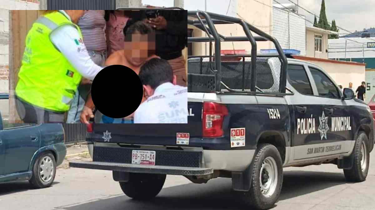Lo citaron para comprar una camioneta en Texmelucan y terminó baleado en una pierna